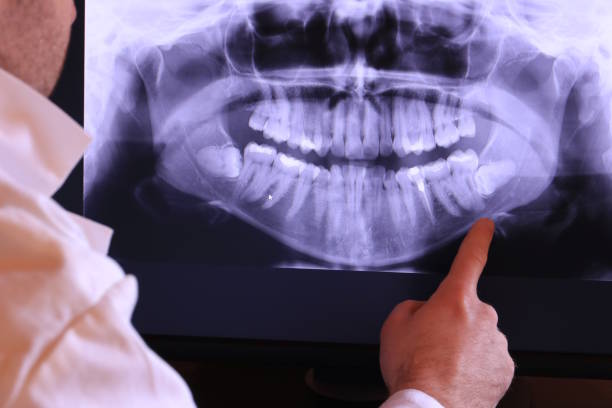 Best Emergency Root Canal Treatment in Ames Lake, WA