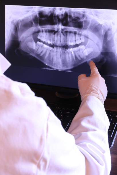 Best Emergency Dentist for Knocked-Out Tooth in Ames Lake, WA
